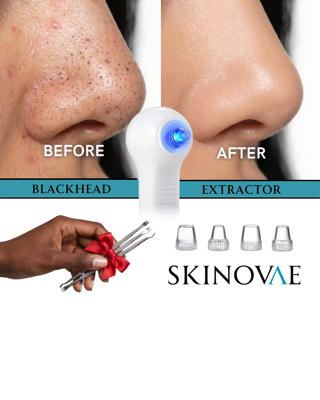 Electric facial cleansing brush & Blackhead extractor